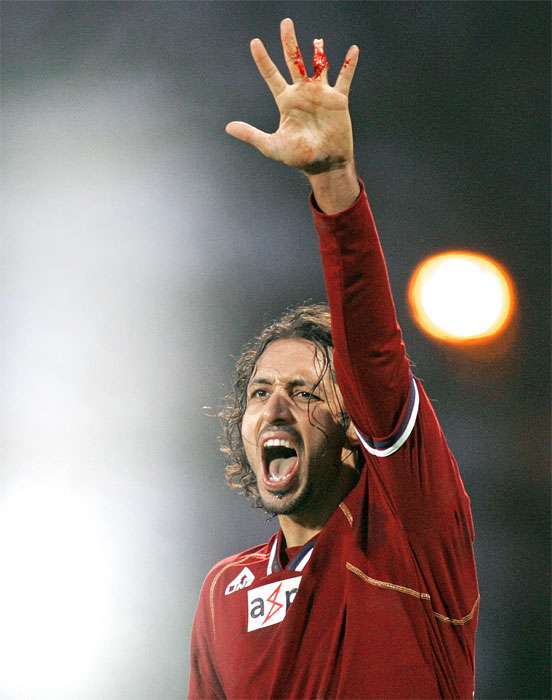 футболисту оторвало палец обручальным кольцом