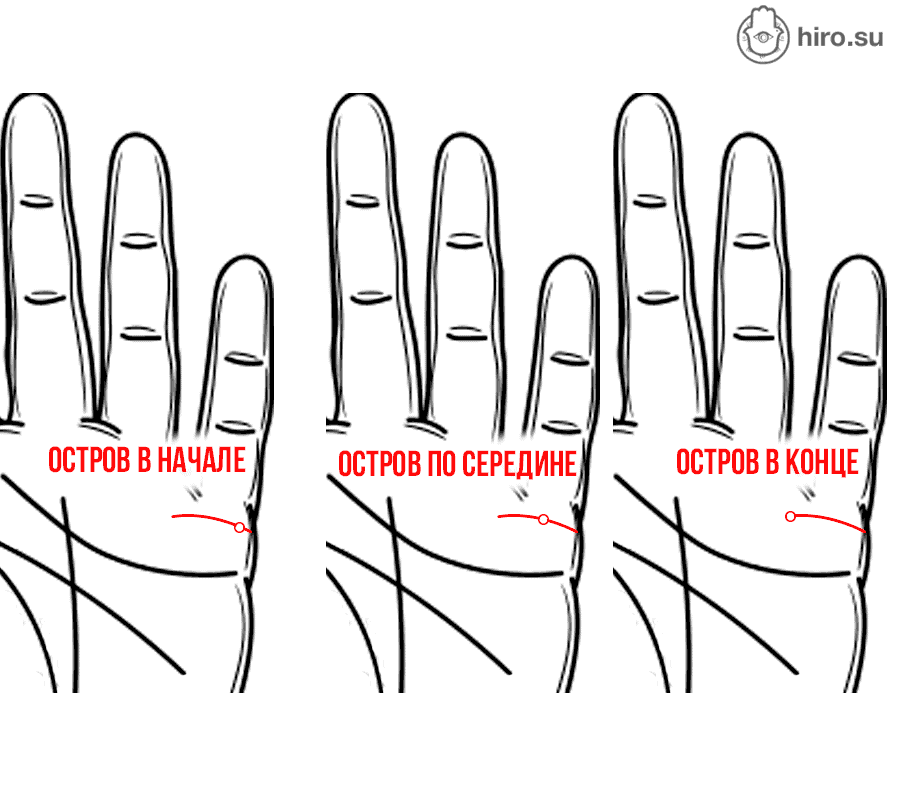 Линия брака