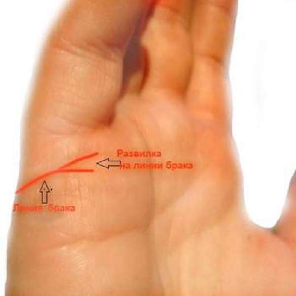 Пример раздвоения линии брака на руке